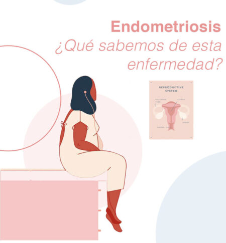 Endometriosis